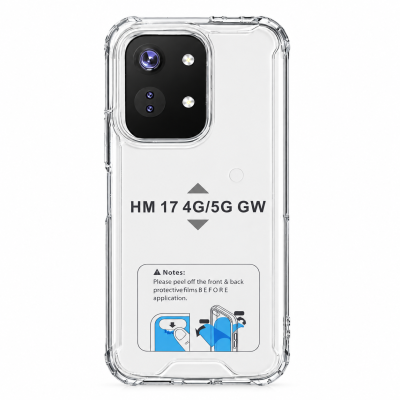 Funda Rígida Transparente Antigolpe Para Xiaomi Redmi 17